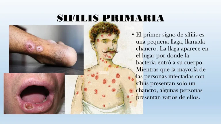 27-SIFILIS